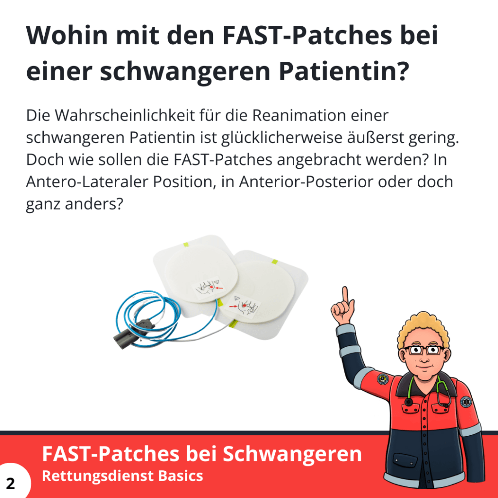 FAST-Patches bei einer Schwangeren